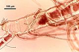 2 - Dettaglio delle cellule basali